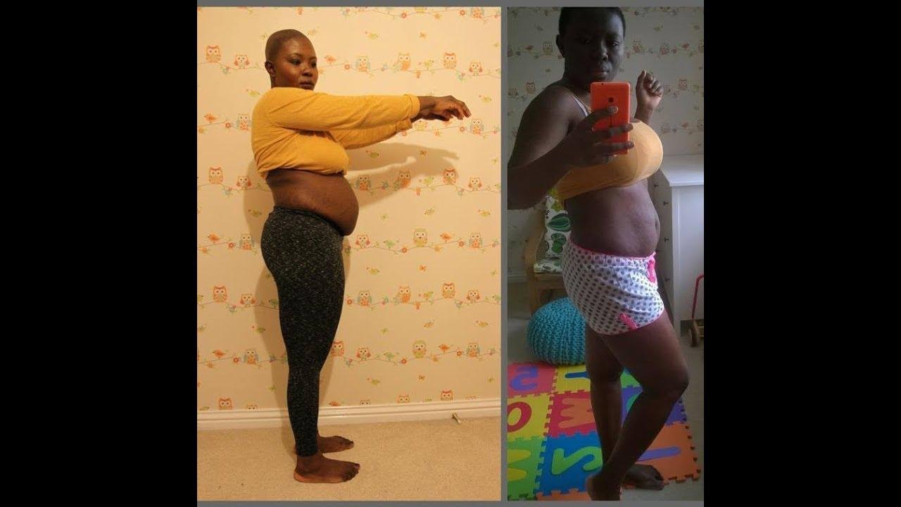 Baking Soda Weight Loss Recipe: Should You Try This Viral Morning Habit?